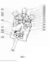 Fig. 02 - Device for correcting ingrowing foot nails and a method for cosmetic correction of ingrowing foot nails