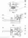 Fig. 03 - Device for correcting ingrowing foot nails and a method for cosmetic correction of ingrowing foot nails