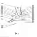 Fig. 04 - Device for correcting ingrowing foot nails and a method for cosmetic correction of ingrowing foot nails