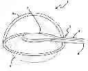 Fig. 01 - Capsulotomy device