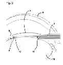 Fig. 03 - Capsulotomy device