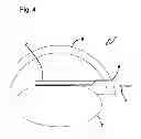 Fig. 07 - Capsulotomy device