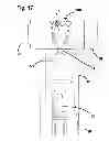 Fig. 20 - Capsulotomy device