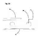 Fig. 23 - Capsulotomy device
