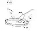 Fig. 28 - Capsulotomy device