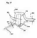 Fig. 30 - Capsulotomy device