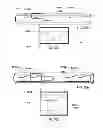Fig. 33 - External fixation