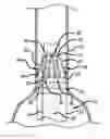 Fig. 01 - System and method of pivoted stent deployment