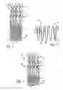 Fig. 03 - System and method of pivoted stent deployment