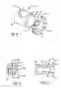 Fig. 06 - System and method of pivoted stent deployment