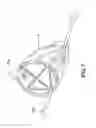Fig. 07 - Methods for implanting medical devices