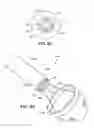 Fig. 09 - Methods for implanting medical devices