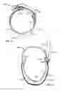 Fig. 11 - Headgear accessory attachment apparatus
