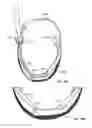 Fig. 12 - Headgear accessory attachment apparatus