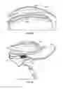 Fig. 16 - Headgear accessory attachment apparatus