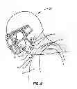 Fig. 07 - Neck protection device