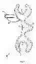 Fig. 02 - PERSONAL PROTECTION DEVICE AND GARMENT INCLUDING SUCH A DEVICE