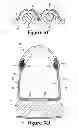Fig. 07 - Method of manufacturing an article of footwear having a knit upper with a polymer layer