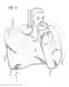 Fig. 07 - BABY TOWEL WRAP