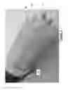 Fig. 06 - Insect Killing Apparatus and Method of Construction
