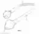 Fig. 04 - Water ski rope safety device