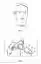 Fig. 02 - Adjustable and biased-open unidirectional speaking valve