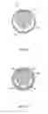 Fig. 06 - Adjustable and biased-open unidirectional speaking valve