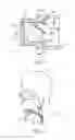 Fig. 07 - Adjustable and biased-open unidirectional speaking valve