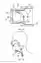 Fig. 08 - Adjustable and biased-open unidirectional speaking valve