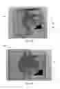 Fig. 10 - Adjustable and biased-open unidirectional speaking valve