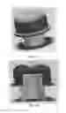 Fig. 14 - Adjustable and biased-open unidirectional speaking valve