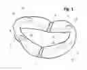 Fig. 02 - Incremental and/or successive adjustable mandibular advancement device for preventing and treatment of snoring and obstructive sleep apnea