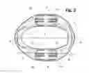 Fig. 04 - Incremental and/or successive adjustable mandibular advancement device for preventing and treatment of snoring and obstructive sleep apnea