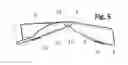 Fig. 06 - Incremental and/or successive adjustable mandibular advancement device for preventing and treatment of snoring and obstructive sleep apnea