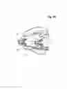 Fig. 44 - Incremental and/or successive adjustable mandibular advancement device for preventing and treatment of snoring and obstructive sleep apnea