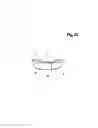 Fig. 48 - Incremental and/or successive adjustable mandibular advancement device for preventing and treatment of snoring and obstructive sleep apnea