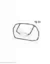 Fig. 63 - Incremental and/or successive adjustable mandibular advancement device for preventing and treatment of snoring and obstructive sleep apnea