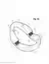Fig. 64 - Incremental and/or successive adjustable mandibular advancement device for preventing and treatment of snoring and obstructive sleep apnea
