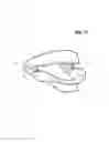 Fig. 72 - Incremental and/or successive adjustable mandibular advancement device for preventing and treatment of snoring and obstructive sleep apnea