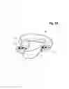 Fig. 75 - Incremental and/or successive adjustable mandibular advancement device for preventing and treatment of snoring and obstructive sleep apnea
