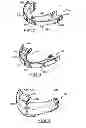 Fig. 03 - ORAL APPLIANCE FOR PROTECTING THE TEETH OF A USER