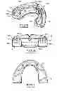 Fig. 04 - ORAL APPLIANCE FOR PROTECTING THE TEETH OF A USER