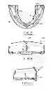 Fig. 05 - ORAL APPLIANCE FOR PROTECTING THE TEETH OF A USER
