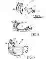 Fig. 08 - ORAL APPLIANCE FOR PROTECTING THE TEETH OF A USER
