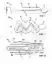 Fig. 02 - Convertible wiping device