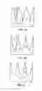 Fig. 07 - Arrangements with pyramidal features having at least one nanostructured surface and methods of making and using