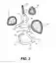 Fig. 04 - Ornamentation System