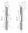 Fig. 02 - Connecting arrangement for connecting a fiber composite component to a second component