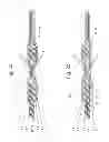 Fig. 04 - Connecting arrangement for connecting a fiber composite component to a second component
