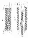 Fig. 08 - Connecting arrangement for connecting a fiber composite component to a second component